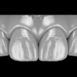 preview-4.png All Collection For exocad