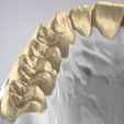 24.jpg 3D Dental Jaws Replica with Detachable Teeth