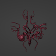 t7.png 3D Model of Middle Cerebral Artery (MCA) Aneurysm