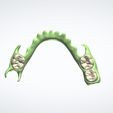 Clipboard-2024-05-06-10-57-24.jpg DIGITAL LOWER PARTIAL REMOVABLE DENTURE - flexible