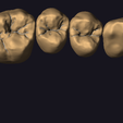 Screenshot-2023-11-02-154534.png teeth libraries