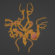 w7.png 3D Model of Middle Cerebral Artery (MCA) Aneurysm