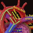ps-0030.jpg PDA Patent Ductus Arteriosus vs Normal blood circulation