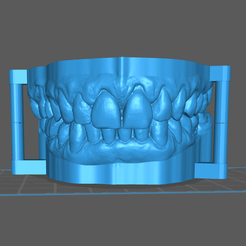 Modelos dentales.PNG Articulated dental models