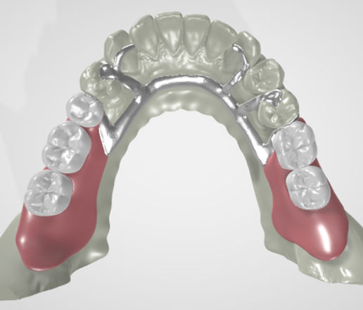 健康・医学 Best Denture Design 健康・医学 Best Denture Design Functional Denture Set Upper