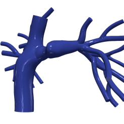 chd.png.25a68748c10bcac4c80246a6b75d8c05.png 3D Model of Pulmonary Arteries (Fontan Procedure)