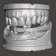 2.png Dental Models Articulated and Dental Bar
