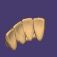 Clipboard-2024-12-21-00-09-11.jpg DIGITAL FLEXIBLE PARTIAL DENTURES upper + lower (3D models !!!) - 12 stl files for download