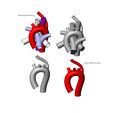 ARSA-V2-08.jpg Aberrant right subclavian artery anomaly 3D print model