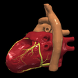 12.png 3D Model of Transposition of the Great Arteries Open Duct