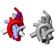 ARSA-V2-10.jpg Aberrant right subclavian artery anomaly 3D print model