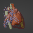 3.png 3D Model of Human Heart with Transposition of Great Arteries (TGA) - generated from real patient