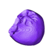 STL00005.stl 3D Model of Human Heart with Aortic Arch Hypoplasia (AAH) - generated from real patient