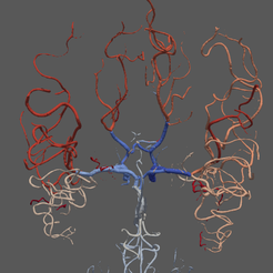 brain1.PNG.839303d28ab4173b243bd83b12ce5230.png Archivo STL Modelo de vasculatura cerebral en 3D・Objeto imprimible en 3D para descargar, blueshirt