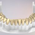 32.jpg 3D Dental Jaws Replica with Detachable Teeth