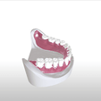 9.png Digital Single Jaw Full Denture