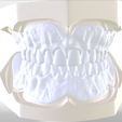 1.png Digital Try-in Full Dentures for Injection Molding