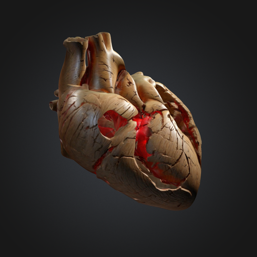 Screenshot-2025-01-20-at-7.34.32 PM.png Broken Heart Human🫀💔