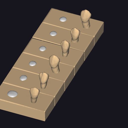 Canine.jpg Exocad Training Sculpter les dents par exemple_ cours quatre_canine supérieure