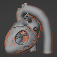 5.png 3D Model of Heart with Tetralogy of Fallot (ToF)