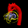 24.png 3D Model of Heart with Tetralogy of Fallot (ToF)