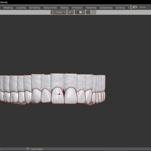 upper arch with socket and textured gums 3D model