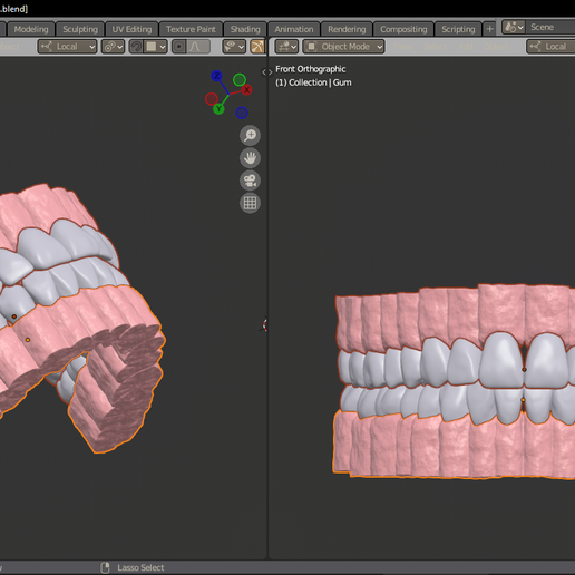 2. UPPER ARCH TEETH WITH SOCKET AND TEXTURED GINGIVA 3D model