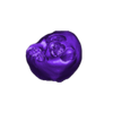 STL00005.stl 3D Model of Human Heart with Co-Arctation (CA) - generated from real patient