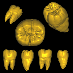 Untitled3.png Mandibular First Molar Anatomy