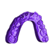 output_model_Upper jaw.stl Dental model with removable dies