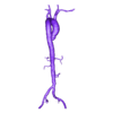 aorta_obj.obj 3D Model of Aorta and Aortic Vessel Tree - generated from real patient