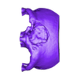 maquette.stl A cranial plate to replace a skull defect (an example of a real operation 2)