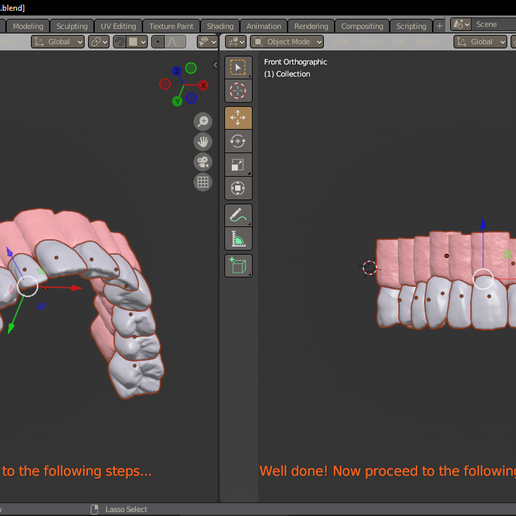 3. UPPER ARCH TEETH WITH SOCKET AND TEXTURED GINGIVA 3D model