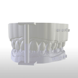 Screenshot_7.png Digital Dental Unsectioned Study Model