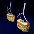 hemorrhoids-piles-3d-model-blend-61.jpg hemorrhoids piles 3D model