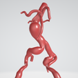 infrarenal-abdominal-aortic-aneurysm.png Case 1 to 6: 3D aortic and iliac artery aneurysm