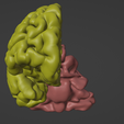 24.png 3D Model of Skull and Brain with Brain Stem
