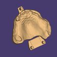 Clipboard-2024-06-11-20-25-39.jpg DIGITAL PARTIAL REMOVABLE DENTURES ( upper + lower + 3D MODELS !) - flexible