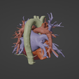 11.png 3D Model of Heart (from real patient)