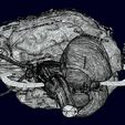 screenshot162.jpg Central nervous system cortex limbic basal ganglia stem cerebel 3D model