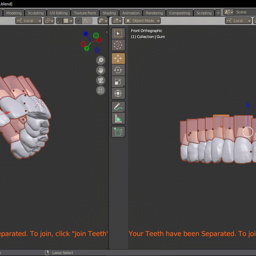 3. UPPER ARCH TEETH WITH SOCKET AND GUM 3D model