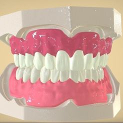 digital-full-dentures-3d-model-stl.png7.jpg Digital Full Dentures