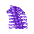 A Pesato reparada 3.stl Scoliosis spine 1