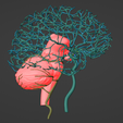 16.png 3D Model of Brain and Aneurysm