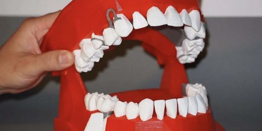 Retrouvez ici une sélection des meilleurs modèles 3D de créations liées au dentaire et à l'orthodontie imprimables en 3D