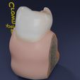 image-0017.jpg Corte esquemático de los dientes etiquetado
