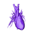 OBJ.obj 3D Model of Human Heart with Co-Arctation (CA) - generated from real patient