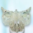 n7.jpg 8 PARTS 3D Magnetic Assemblable Printed Nasal Sinus (maxillary, ethmoid, frontal, sphenoid) Based on Real Patient CT Scan Data