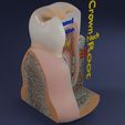 aa0003.jpg Corte esquemático de los dientes etiquetado