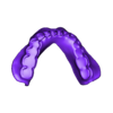 789513050_20230927_1549_Tech_01_0_Print.stl TOTAL REMOVABLE DENTURES - 6 stl files (upper jaw, lower jaw, artificial teeth for upper and lower jaw, 2x monoblock)